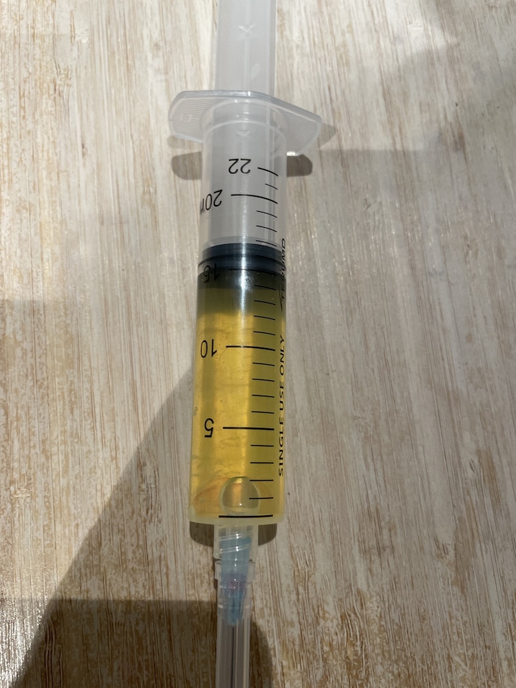 德法旅後心情分享之一：媽媽腳痛